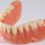 Complete Dentures Type Cost Delhi India